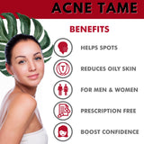 Acnetame Acne Tame supplement capsules on table