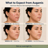 Augamis Niacin B3 Supplement bottle with label