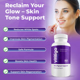 AURA VITAMINS Vitiligo Capsules easy-to-swallow capsules