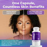 AURA VITAMINS Vitiligo Capsules in hand