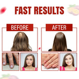 Aurisova Hair Skin Nails Gummies ingredients list on the back