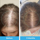 Baby Blues Postpartum Hair Loss Vitamins gummy texture close-up
