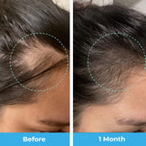 Baby Blues Postpartum Hair Loss Vitamins with tropical fruit background