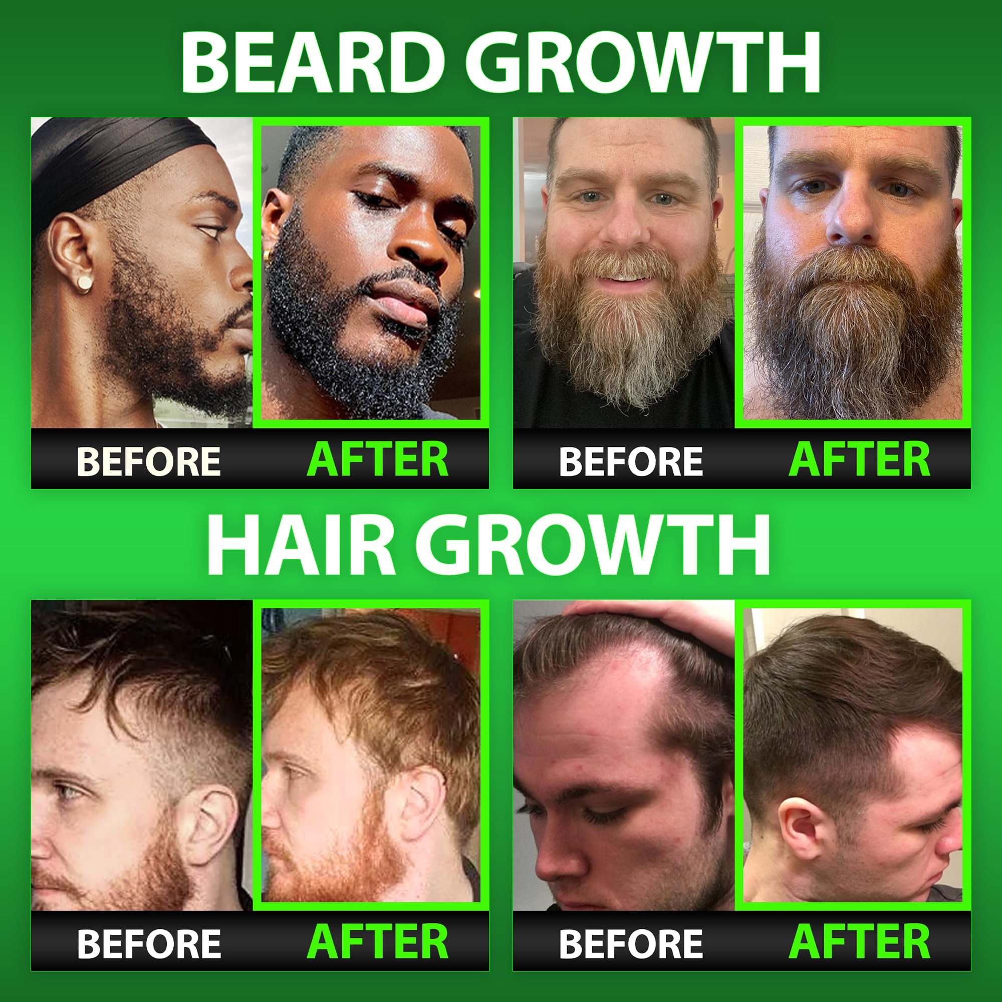 BBS BEST BEARD STUFF Hair & Beard Growth Gummies packaging
