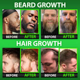 BBS BEST BEARD STUFF Hair & Beard Growth Gummies packaging