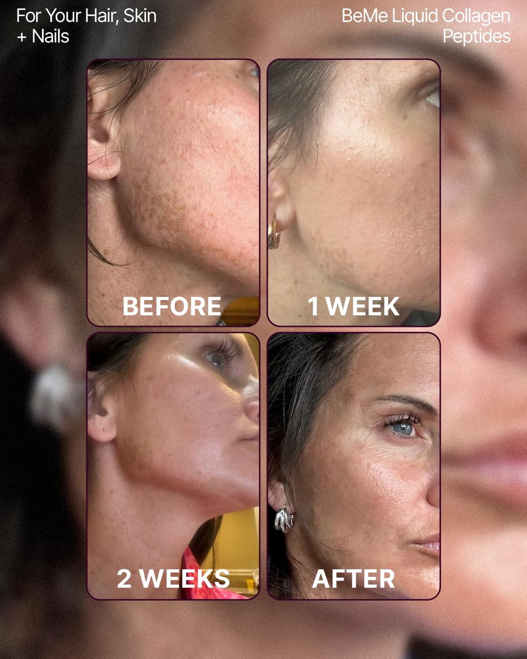 BeMe Collagen Peptides 2500mg Liquid Sachets opened with sachets visible
