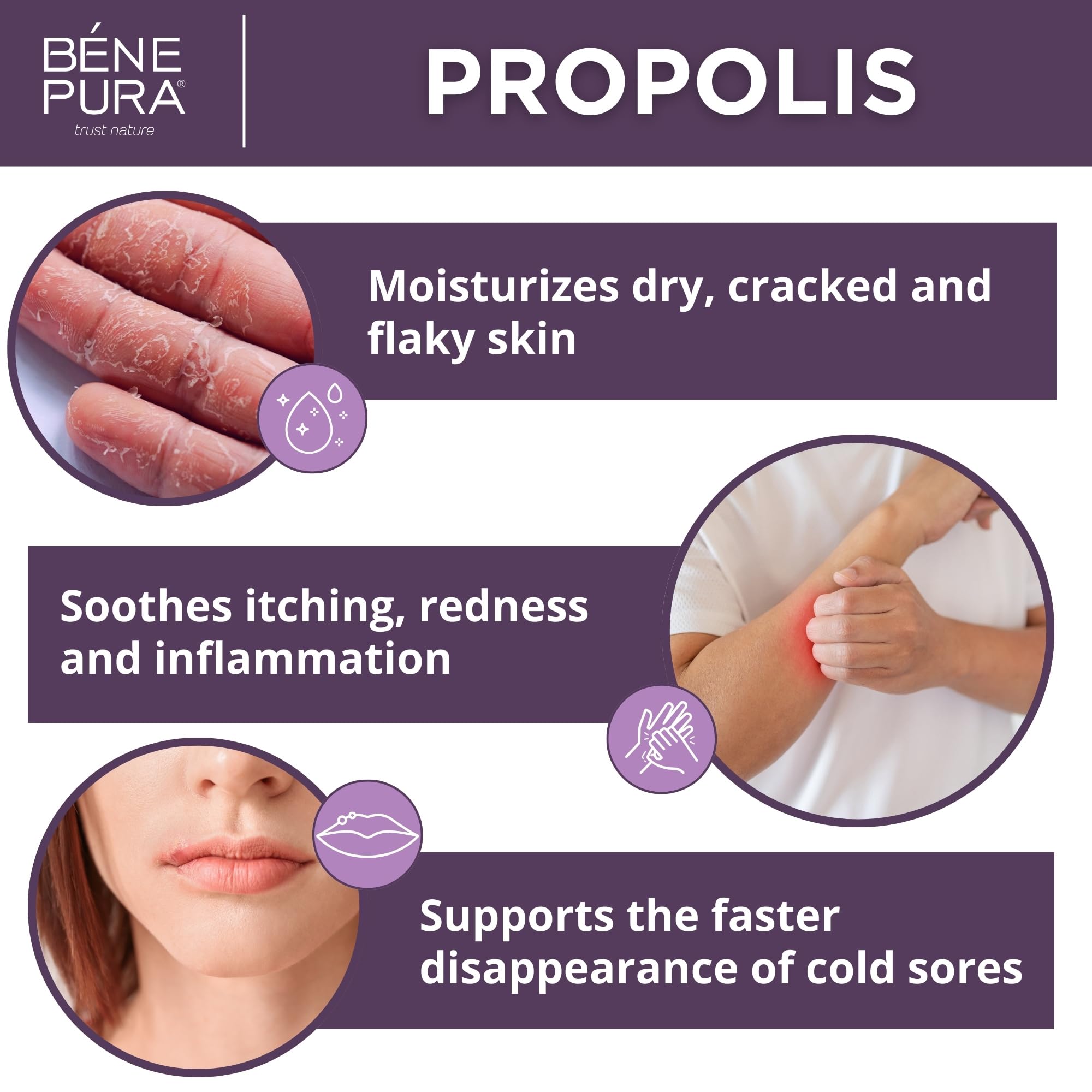 Bene Pura Propolis Anti Itch Cream 40g texture close-up