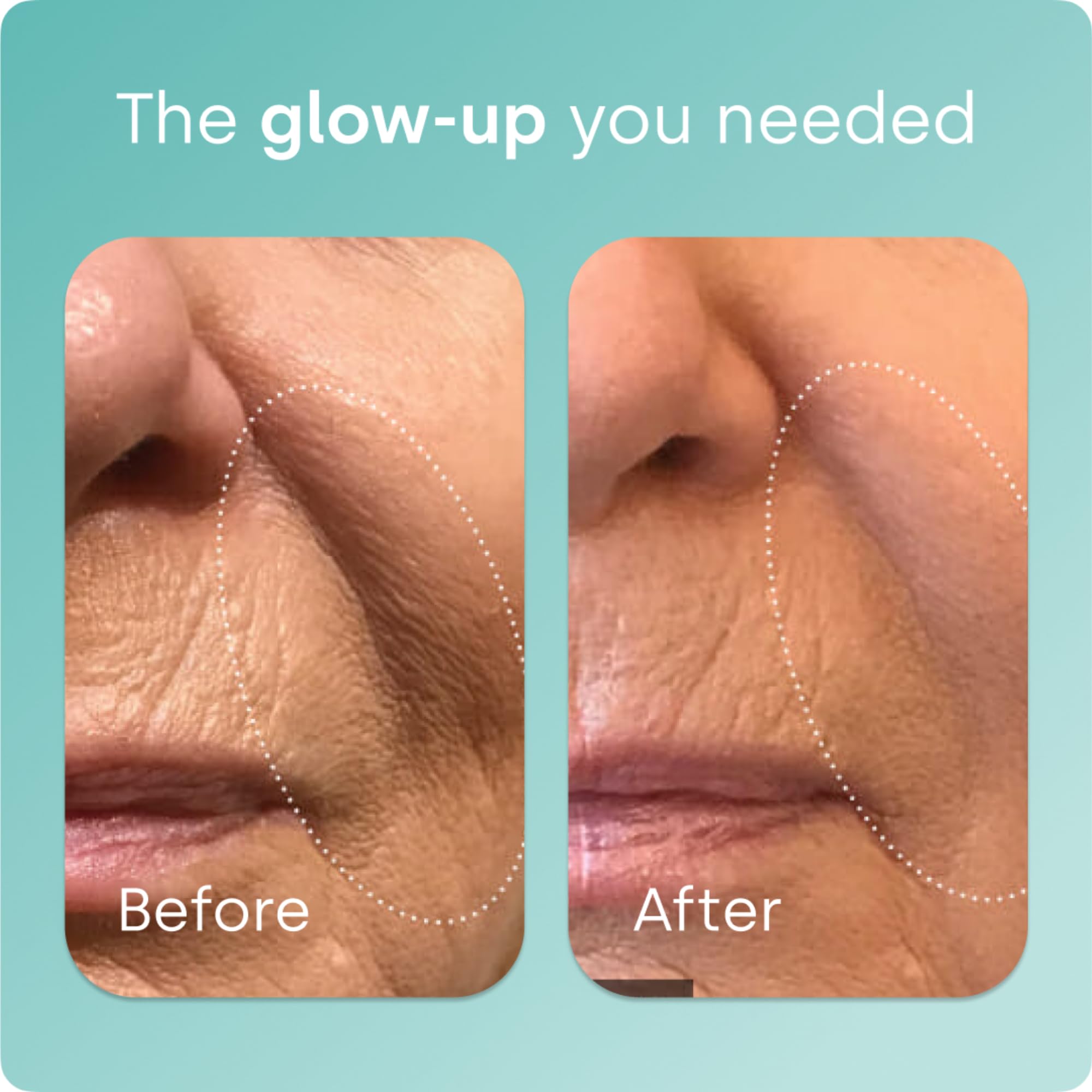 Biosil Collagen Generator 50g side view