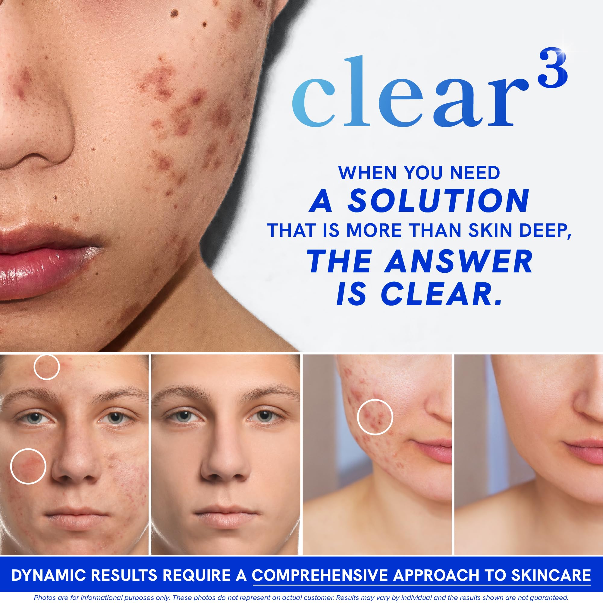 Close-up of SMNutrition Clear Skin Supplement capsules