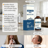 Close-up of Timeno Nasal Care Spray nozzles