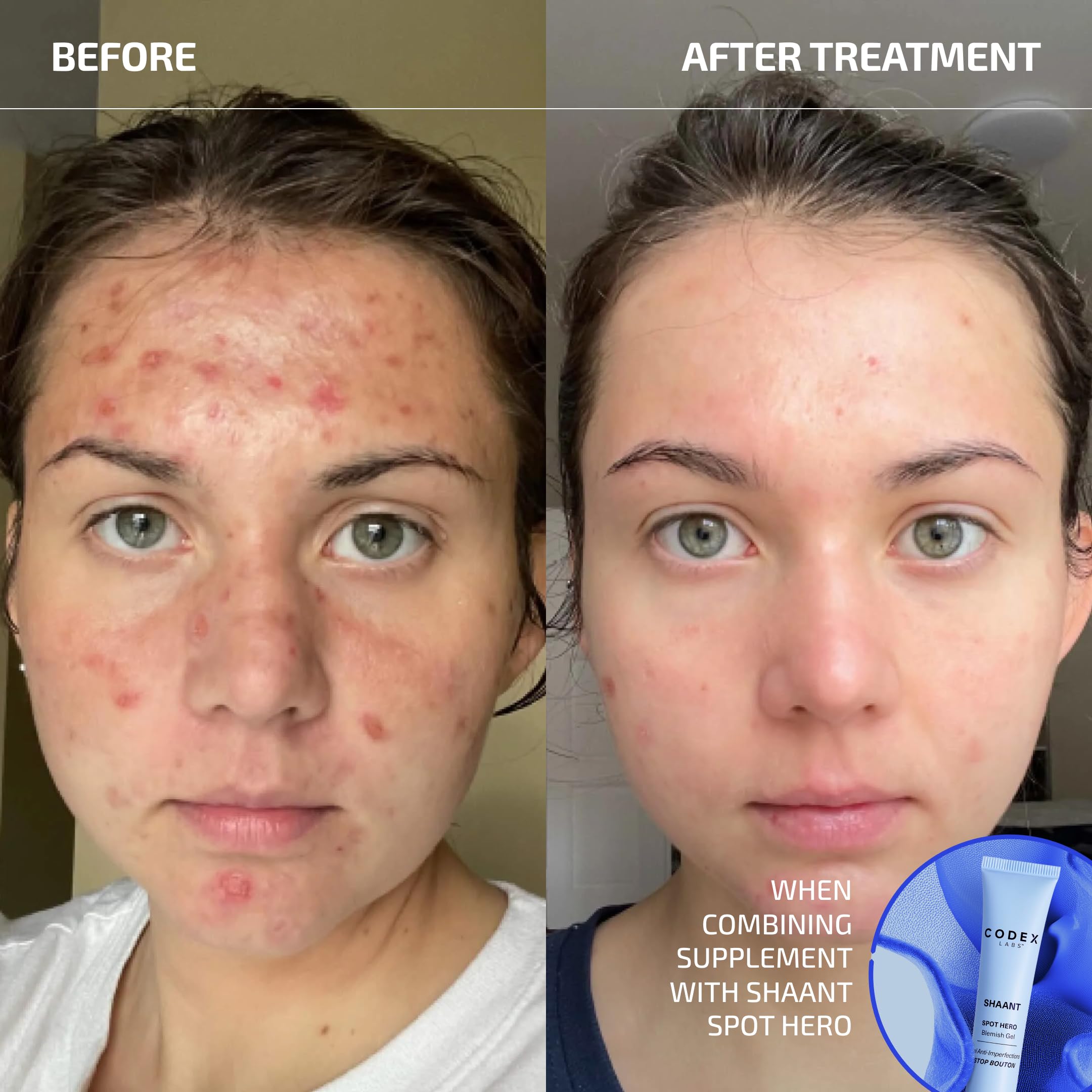 Codex Labs Shaant Clear Skin 2.0 capsules on a wooden surface