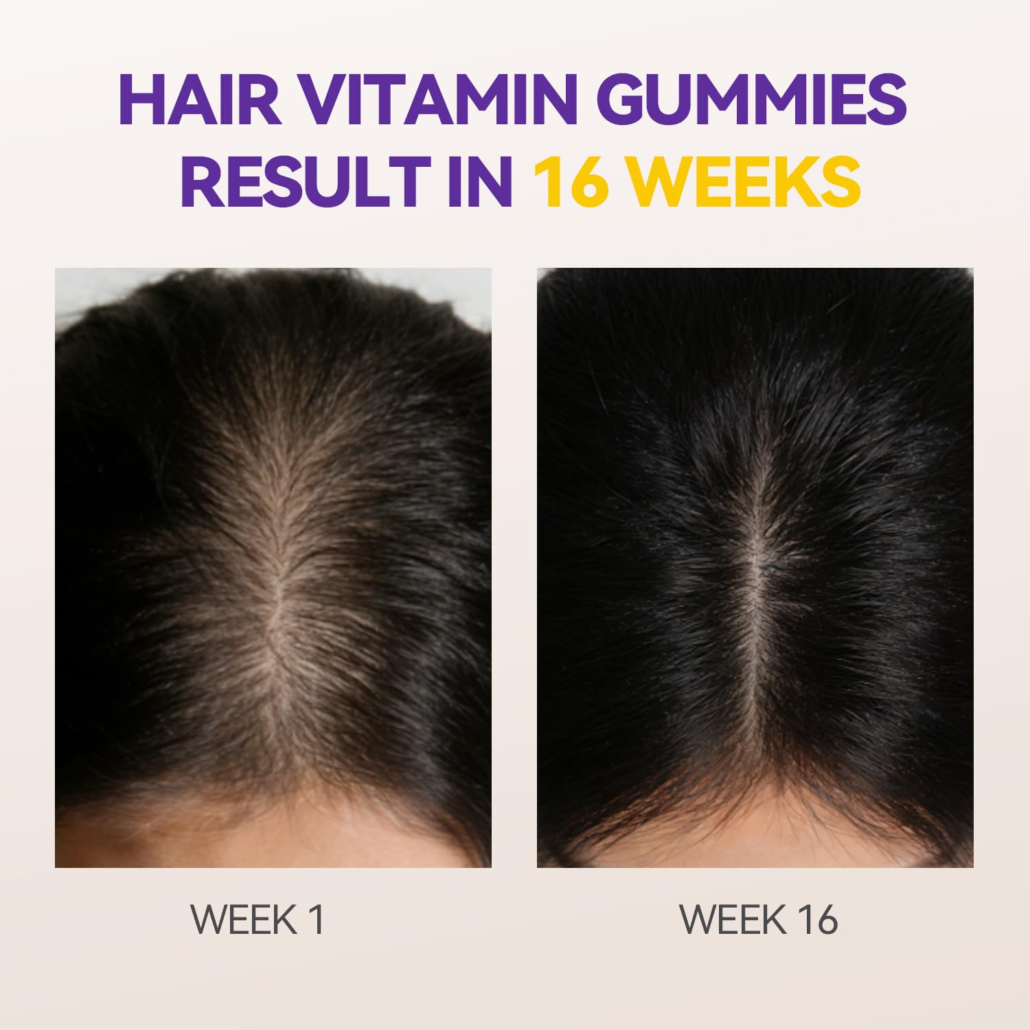 Crasye Hair Growth Gummies vegan pectin ingredients