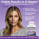 DR. MARTIN'S NUTRITION Resveratrol Supplement displayed with herbs