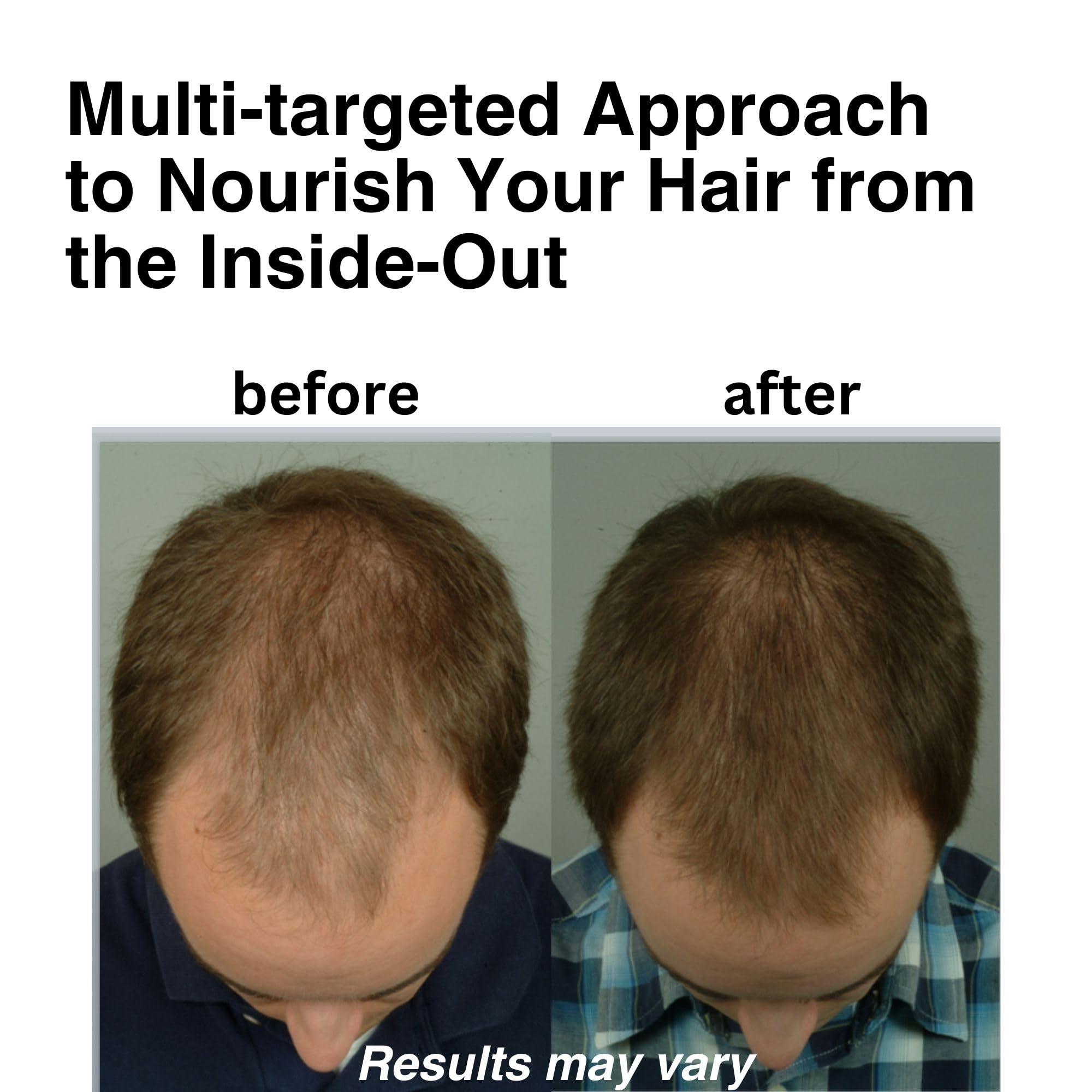 DrSG Saw Palmetto Hair Support Supplement capsules close-up