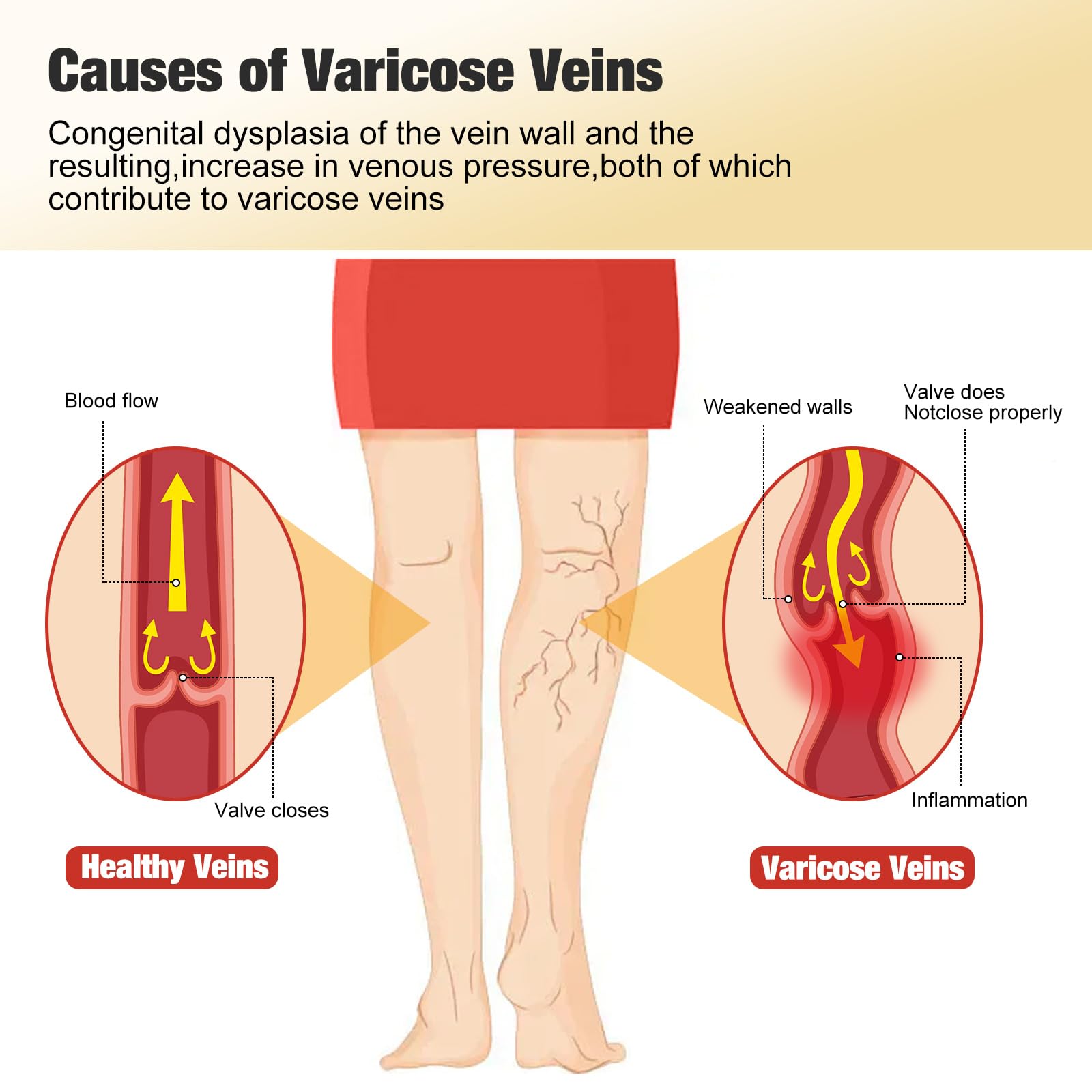 fangtaiabc Varicose Veins Patch lifestyle scene with user applying patch