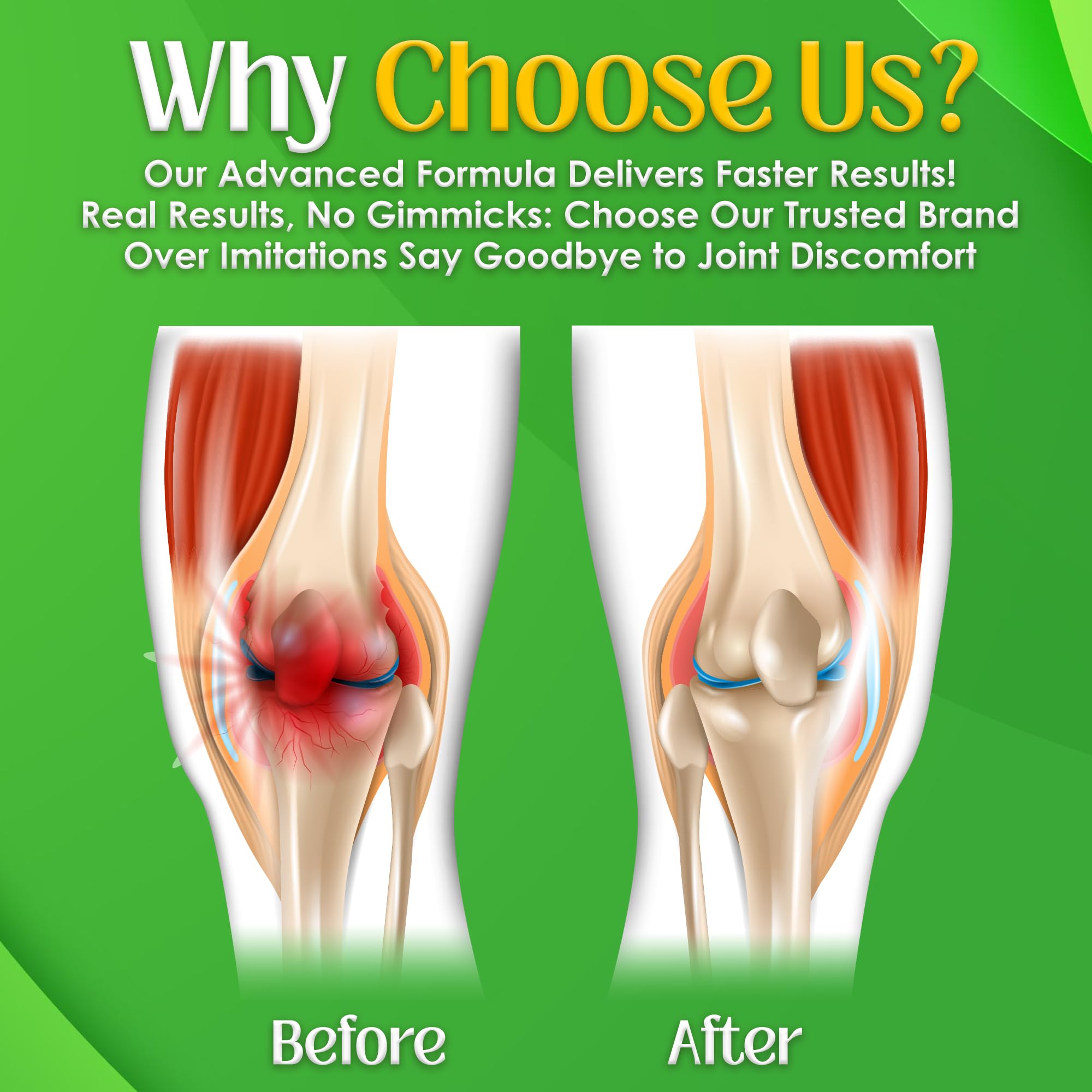Gout and You NutriGout Milk Thistle Supplement capsules on a table