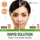 GRAMRIGHT Perfect Skin Acne Supplement capsules on a white background
