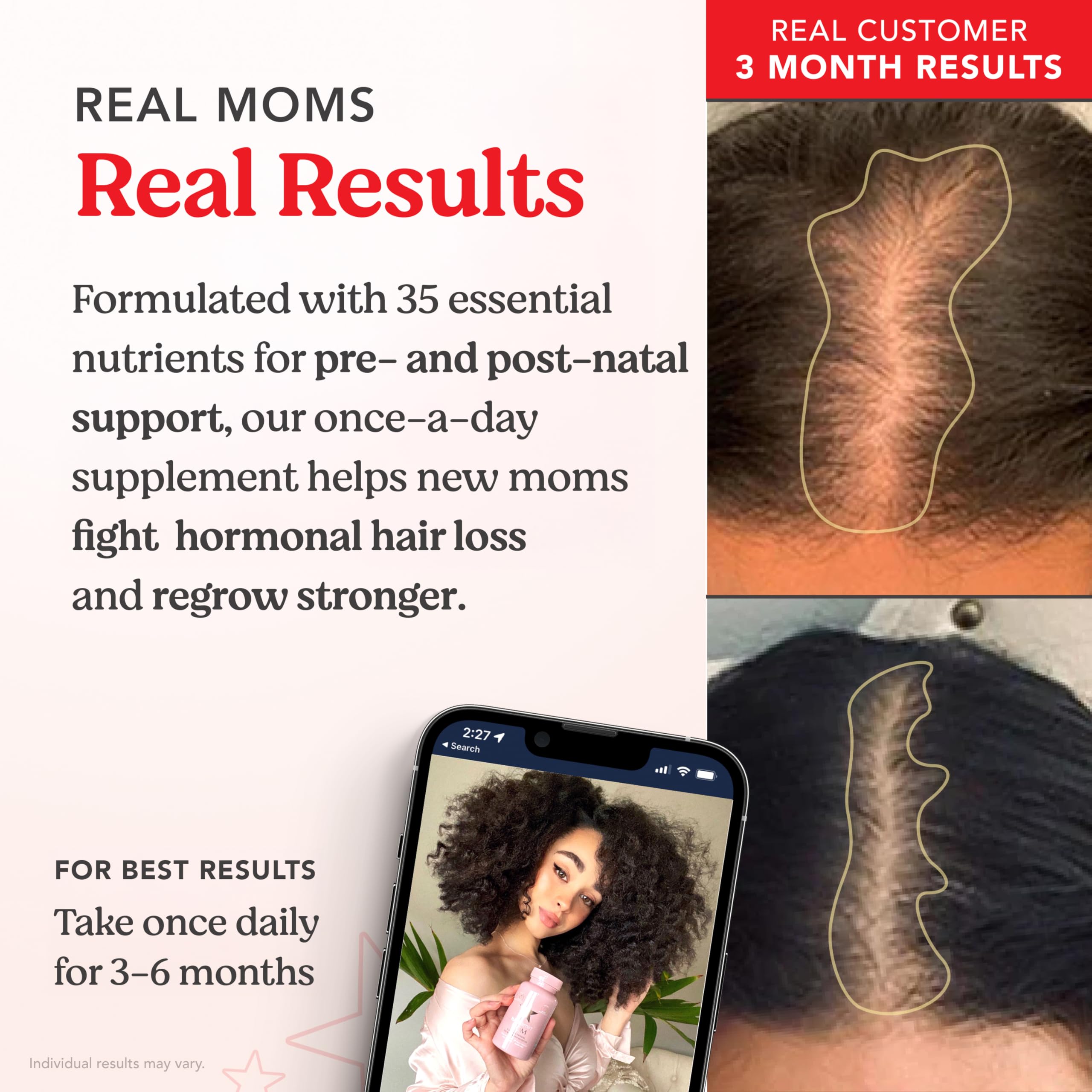 HAIRtamin Prenatal & Postnatal Multivitamin capsules on a wooden surface