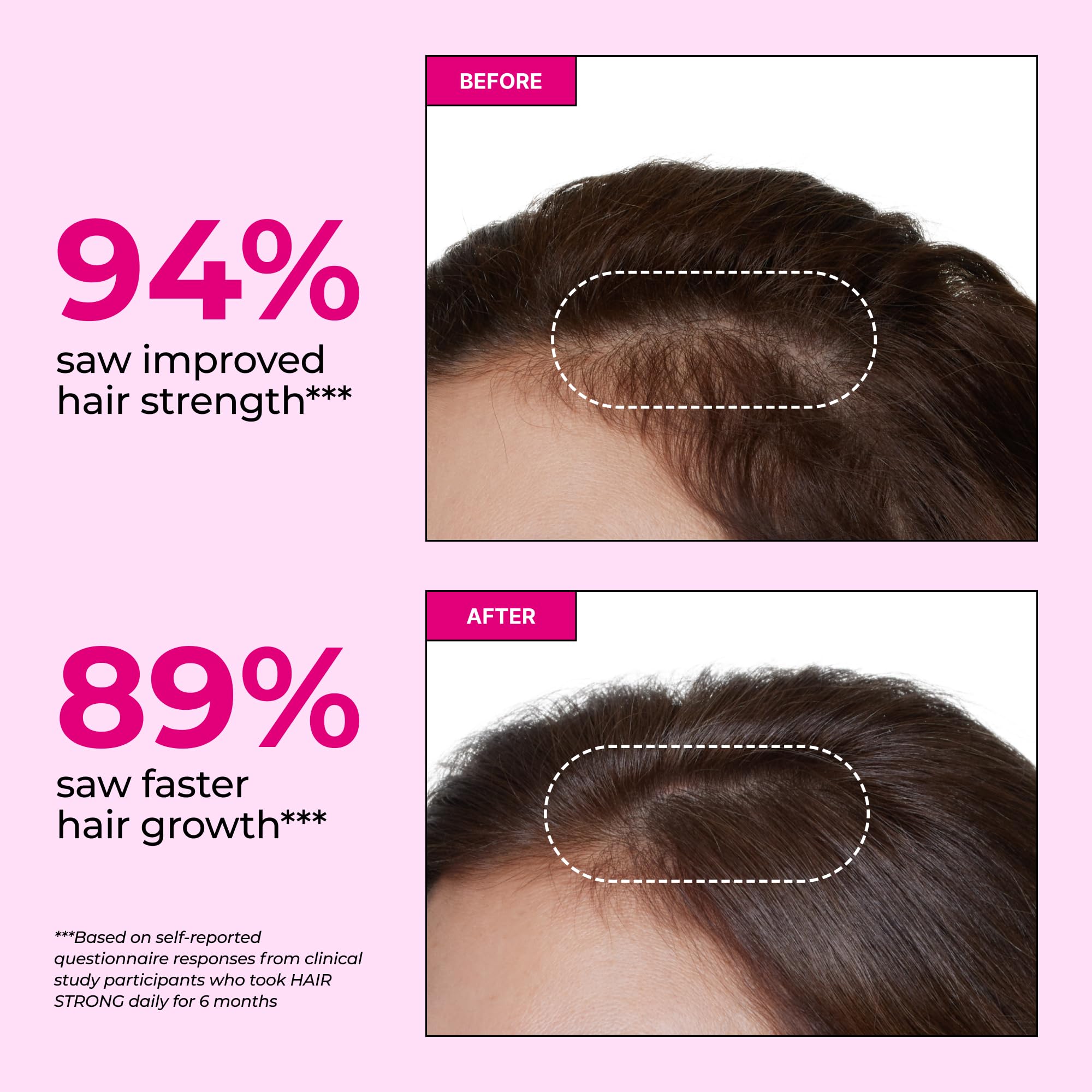 HUM Hair Supplement Capsules showing two capsules