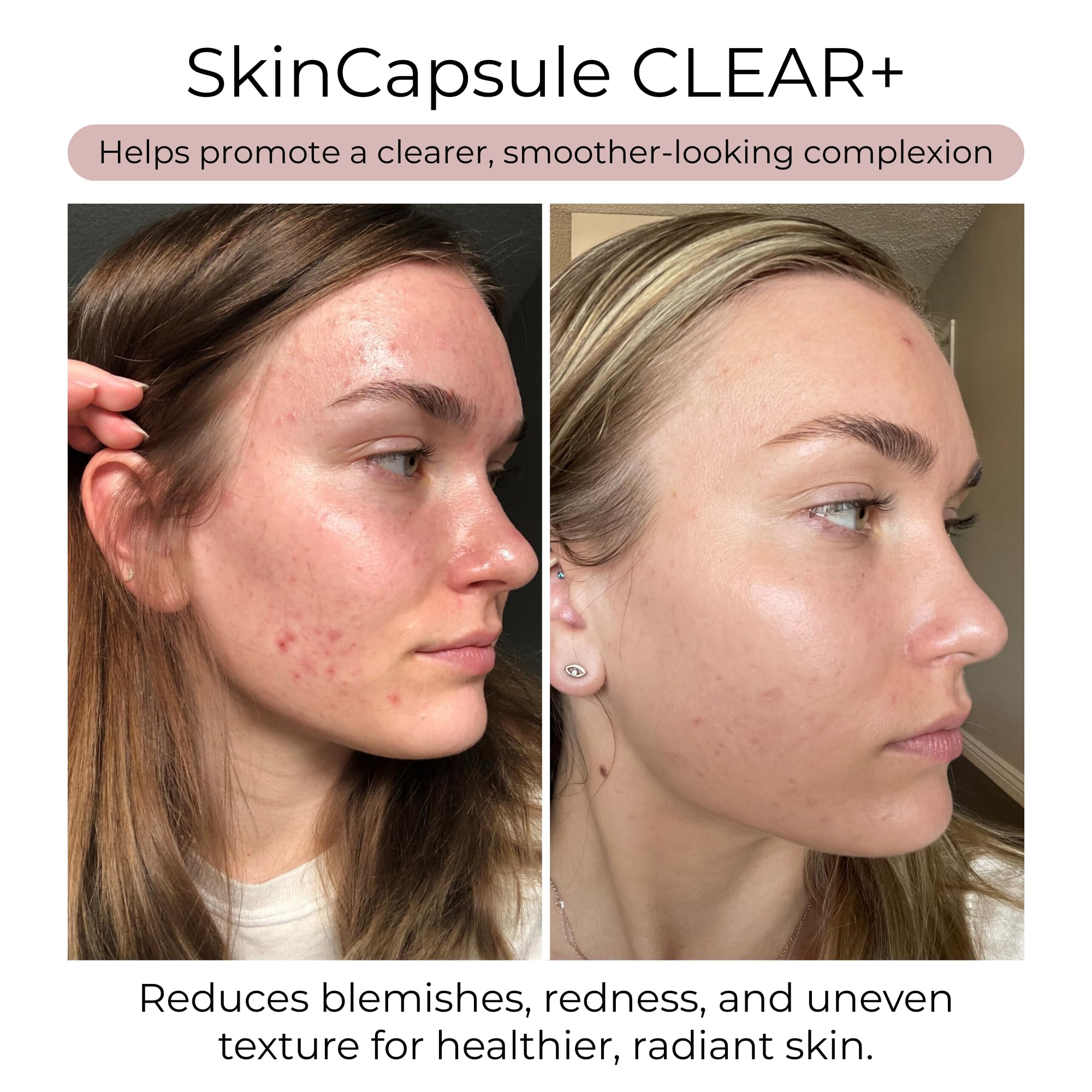 Hush & Hush Turmeric Skin Care Supplement side view