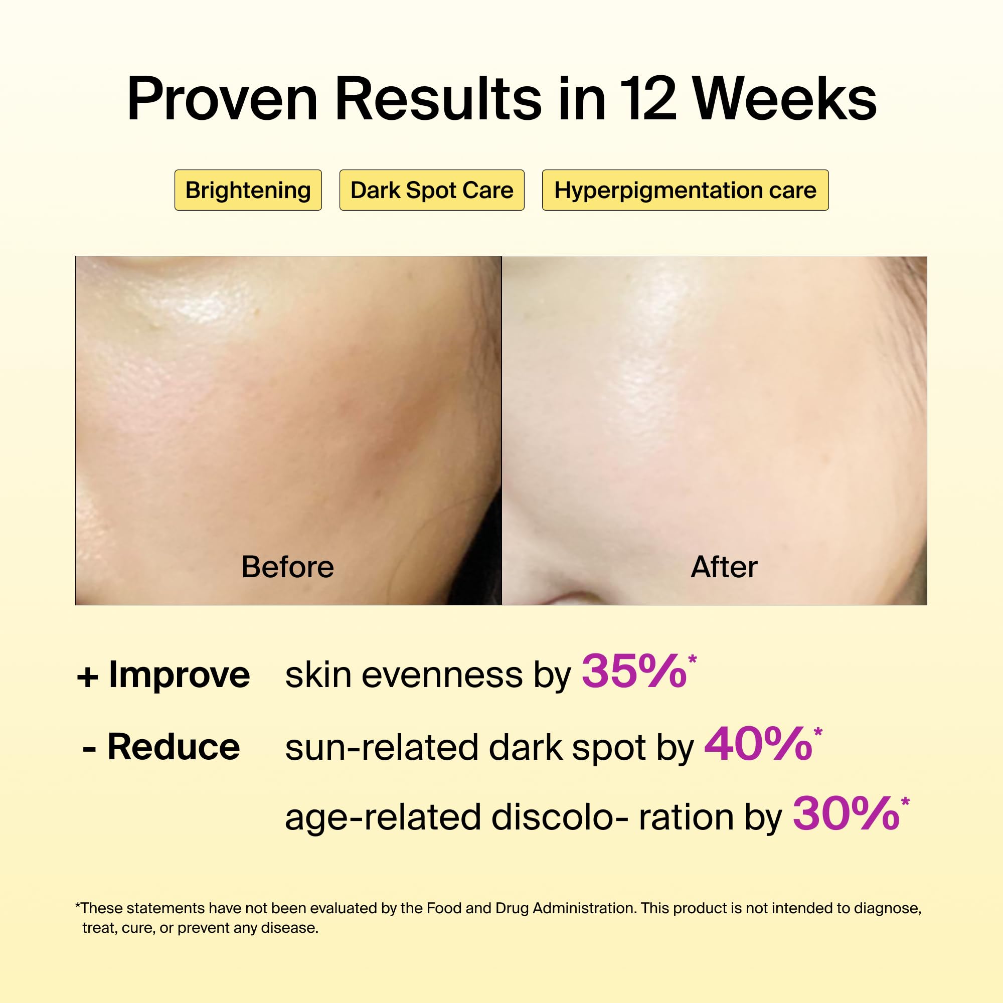 Ingredients list of Ownist Collagen Jelly Supplement