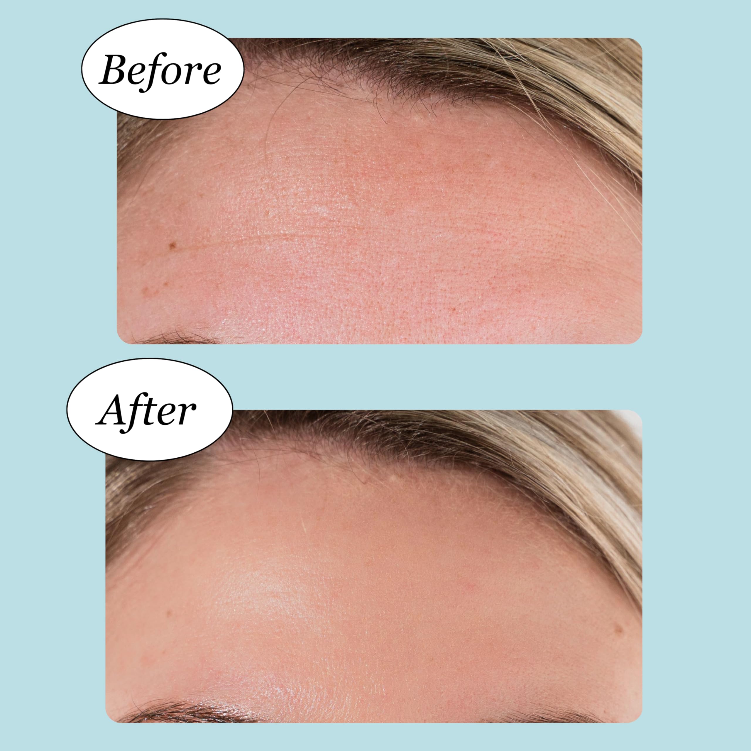 JANE VINE Cooling Collagen Wrinkle Patches application on forehead