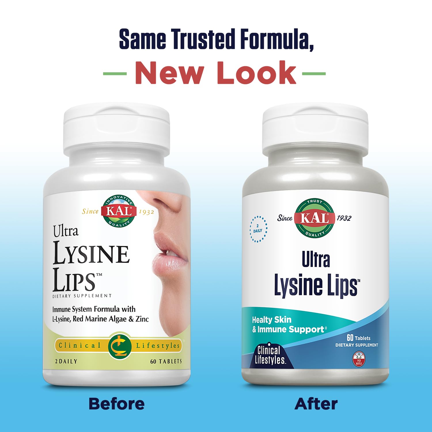 KAL Ultra Lysine Lip Tablets packaging with ingredients list