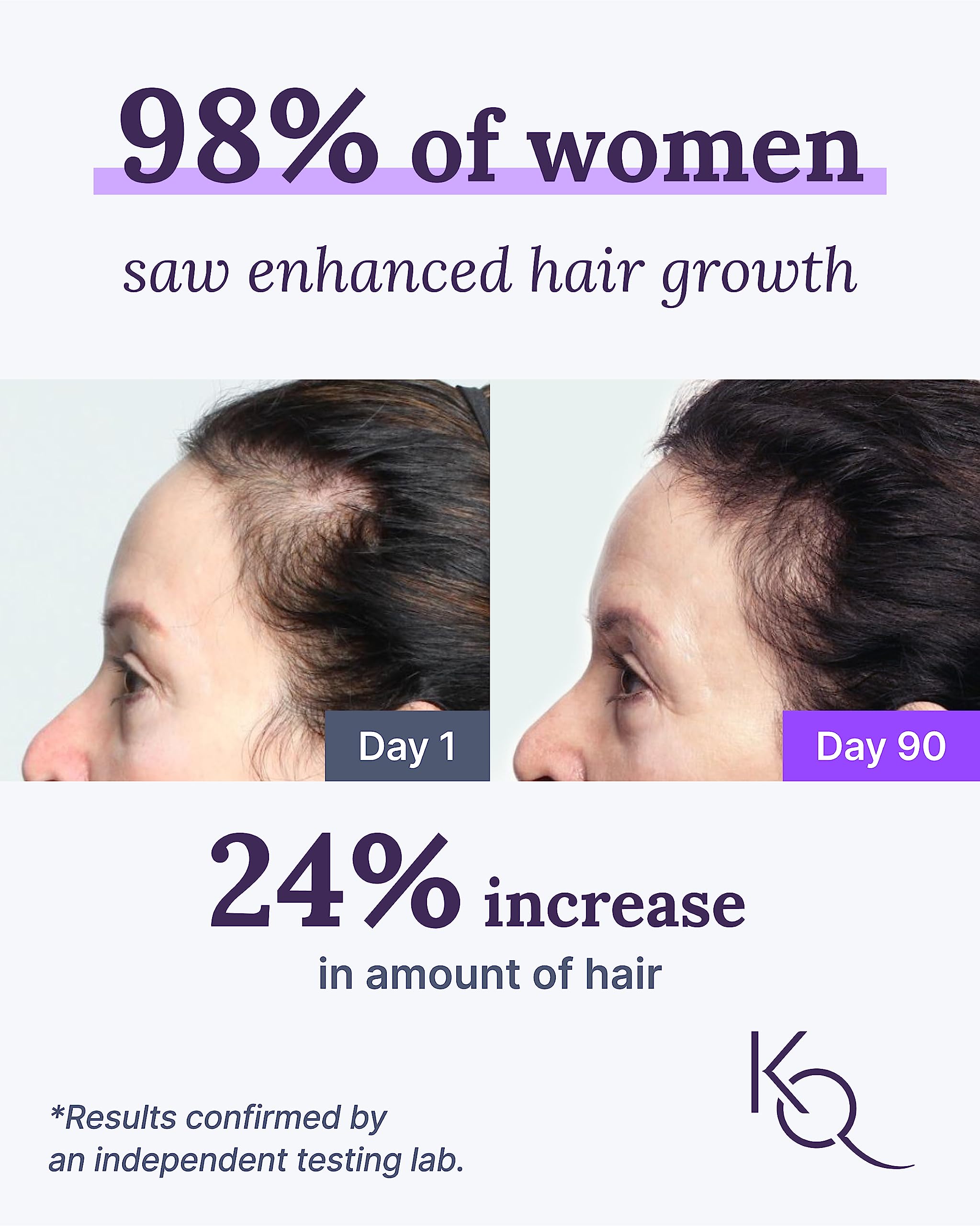 Keranique Hair & Scalp Supplements 240g bottle side view