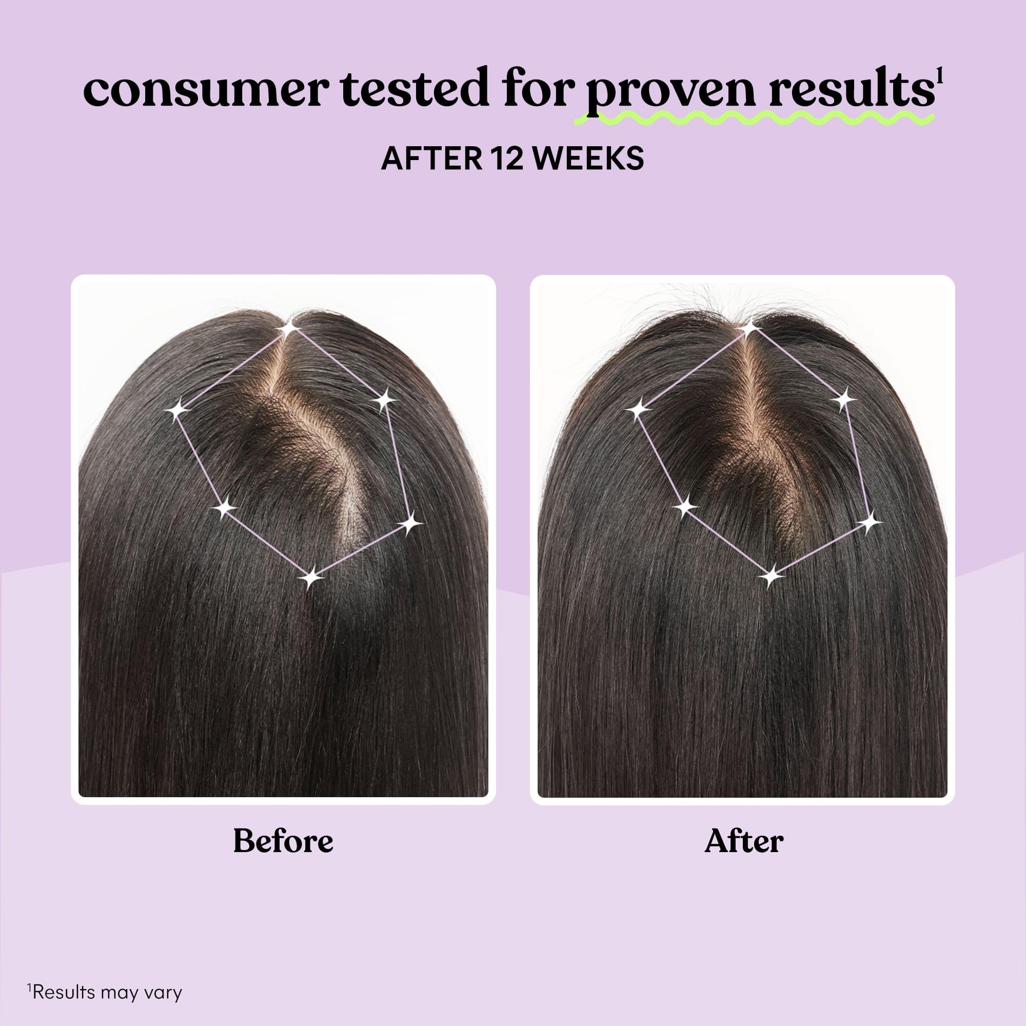 Lemme Hair Growth Supplement capsules on a table