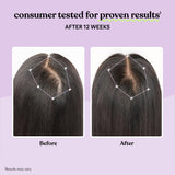 Lemme Hair Growth Supplement capsules on a table