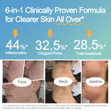 Life-Space Probiotic Acne Support 60 Capsules side view