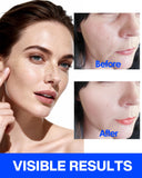 Lifestyle image of zancony Collagen Face Tape in use