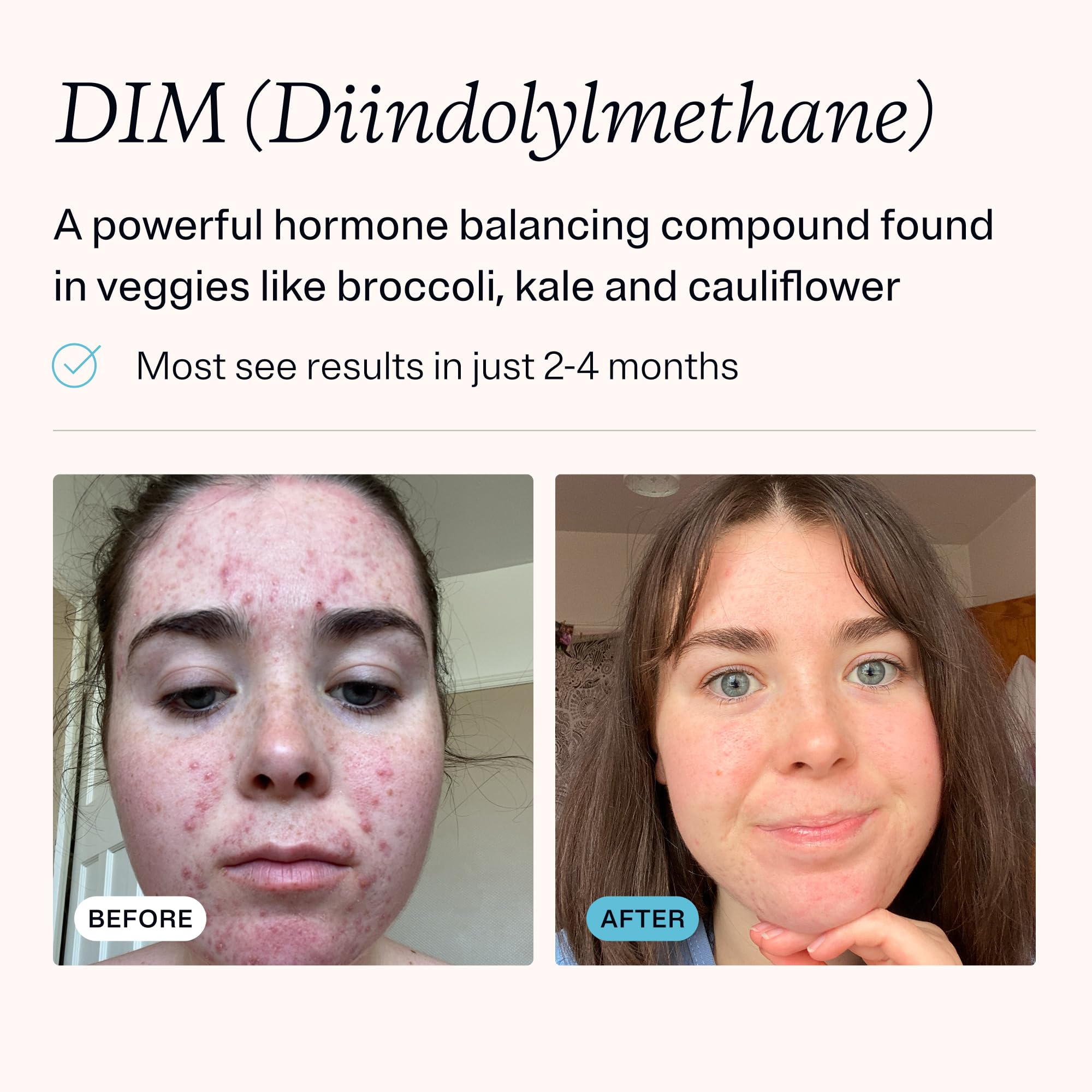 MDacne DIM Skin Clearing Supplements ingredients list