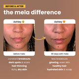 Mela Multivitamin Capsules lifestyle scene on a kitchen counter