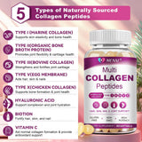 MENXI Collagen Supplement softgel close-up