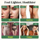 Migcopat Lymphatic Drainage Drops 290g lifestyle scene