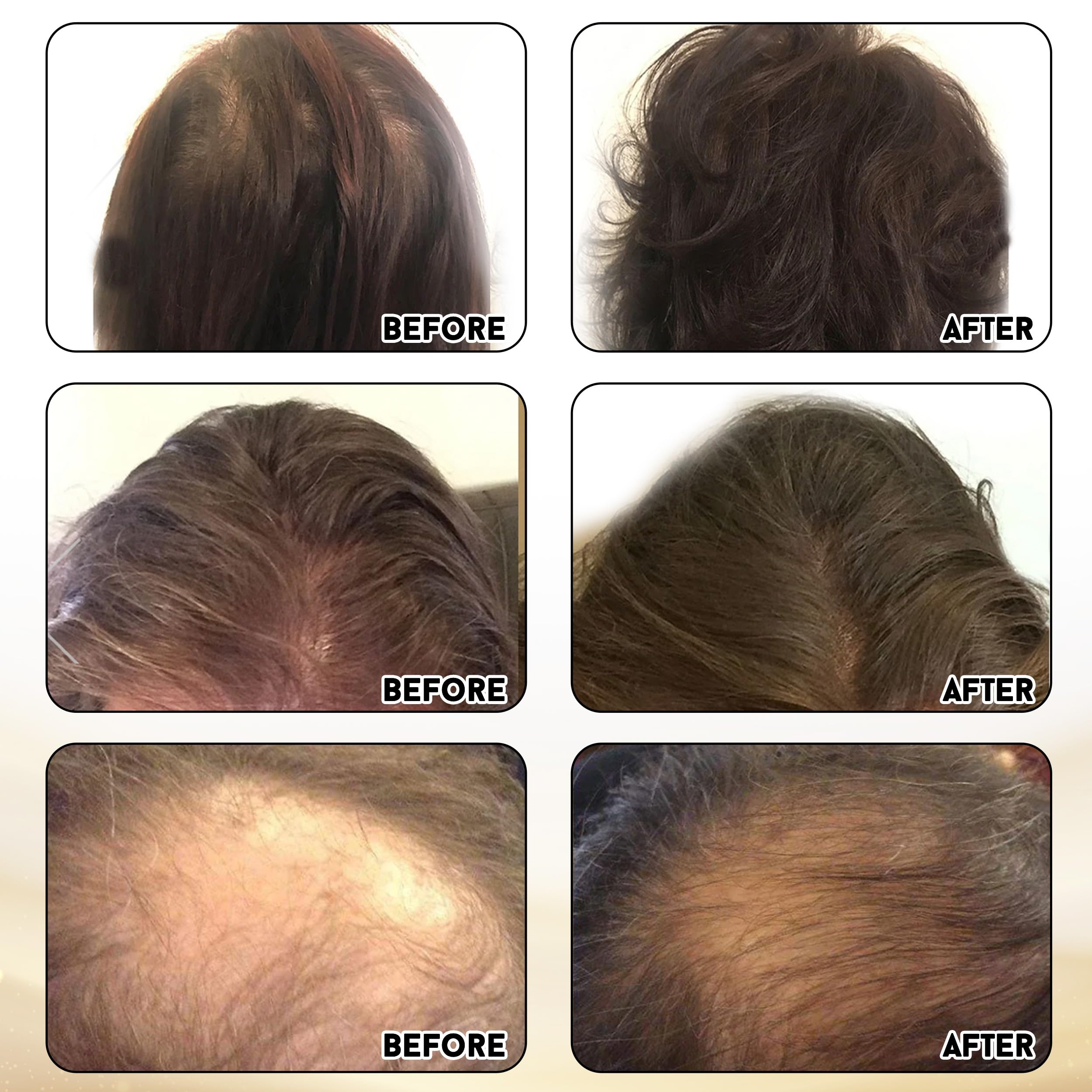Miracle Elixir Collection Hair Supplement lifestyle scene