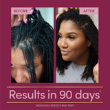 Nature's Bounty Hair Growth Supplement displayed with other supplements