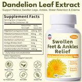 Netrca Swollen Feet Relief Capsules open bottle showing capsules