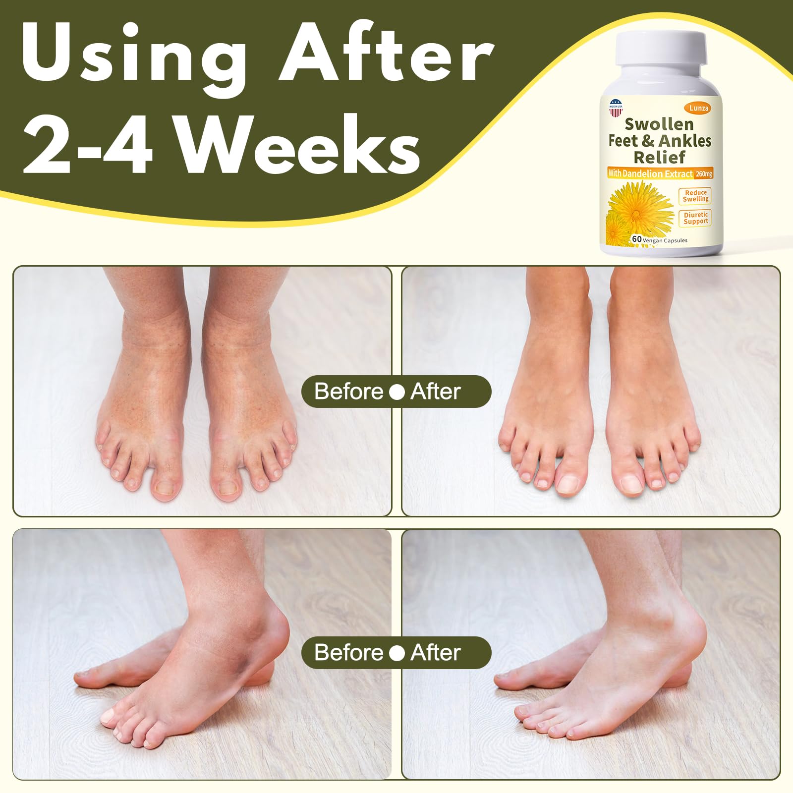 Netrca Swollen Feet Relief Capsules side view with label