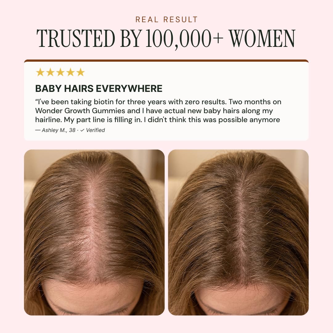 NOOR HAIR Wonder Growth Gummies in a lifestyle setting