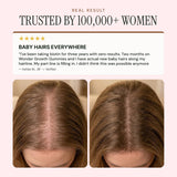 NOOR HAIR Wonder Growth Gummies in a lifestyle setting