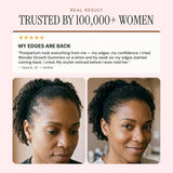 NOOR HAIR Wonder Growth Gummies top view showcasing the gummies