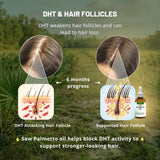 PHYTO LIFE Saw Palmetto Oil 30g packaging