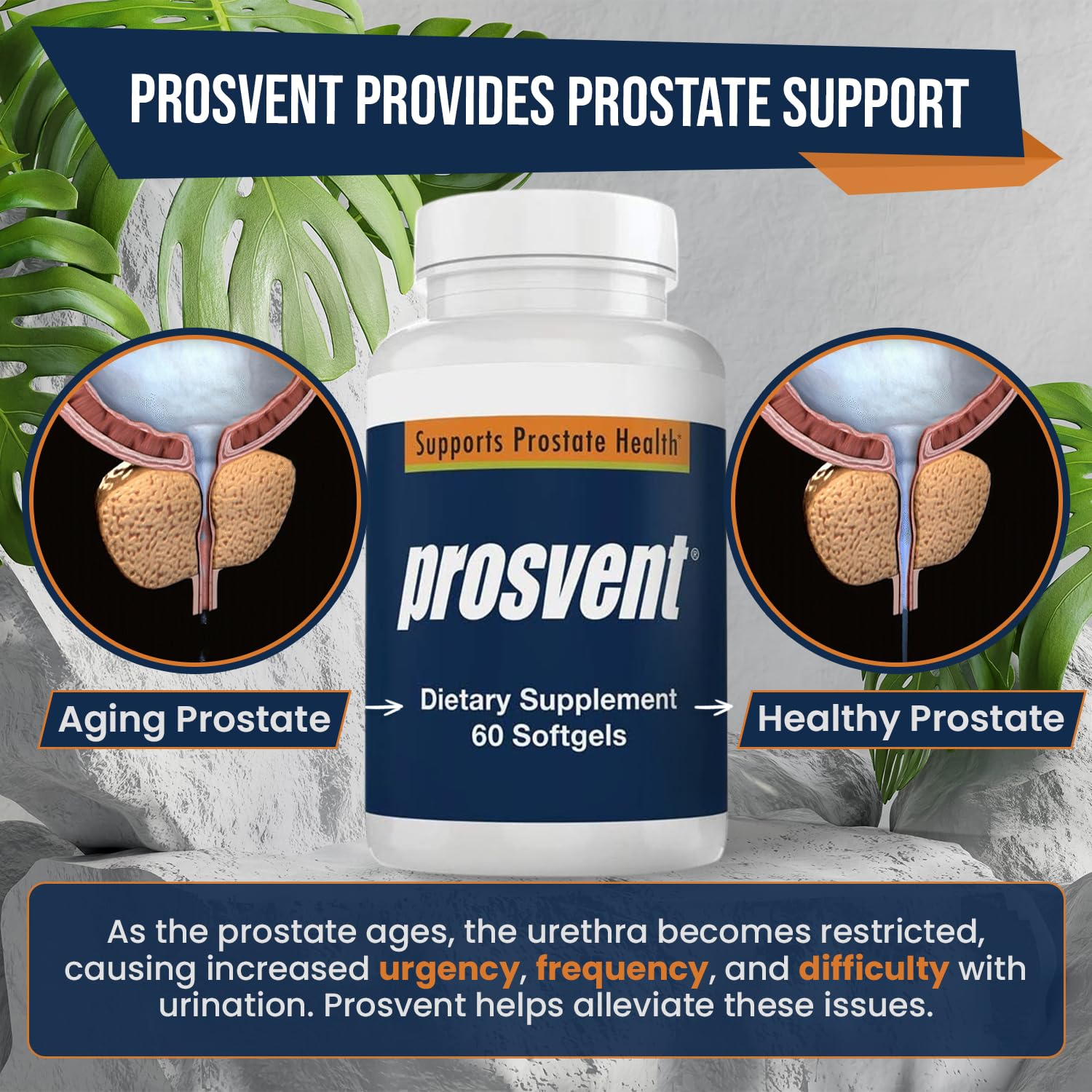 Prosvent Prostate Supplement soft gel capsules in a bowl