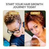 Shedavi Hair + Skin + Nails Herbal Vitamin capsules close-up