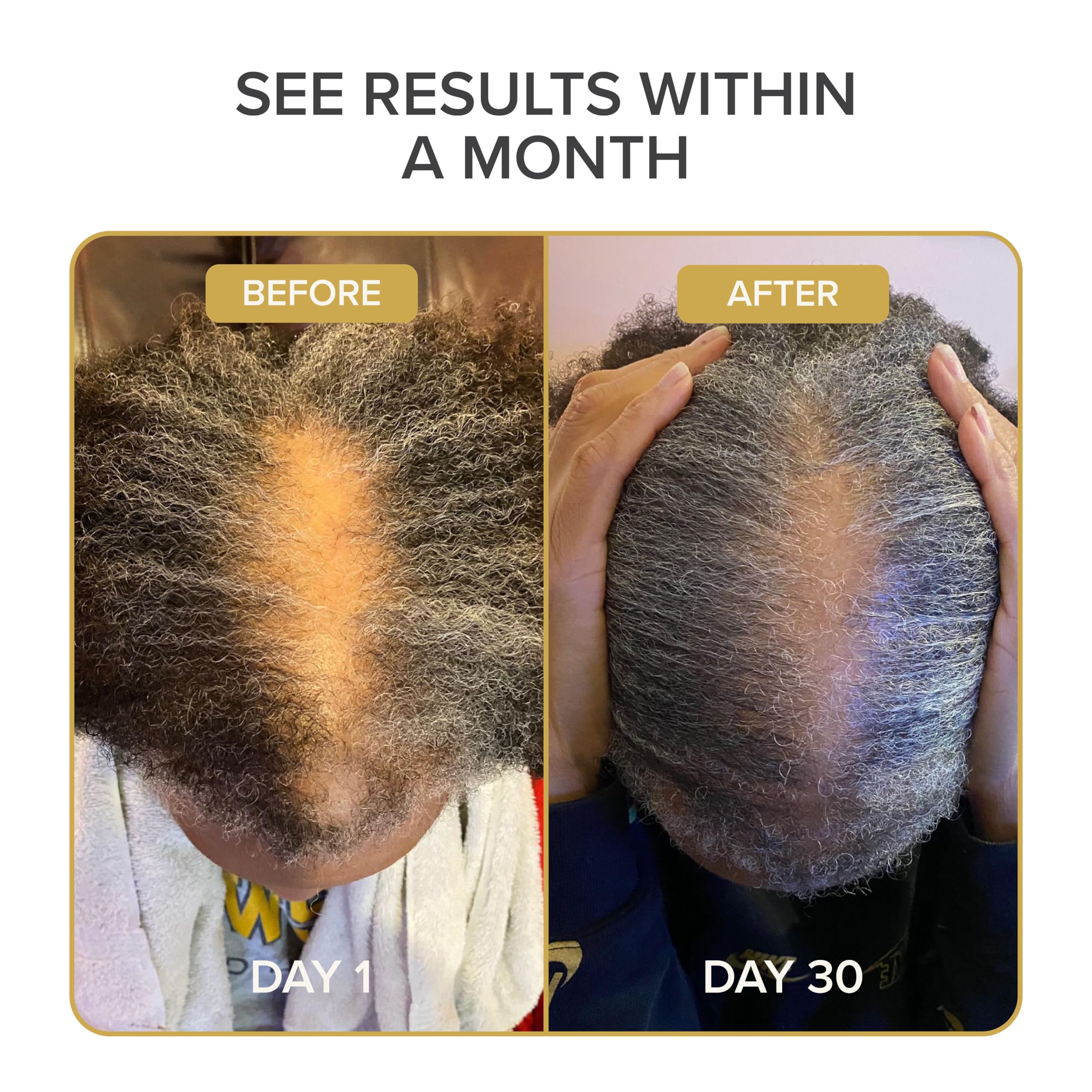 Shedavi Hair + Skin + Nails Herbal Vitamin ingredients list