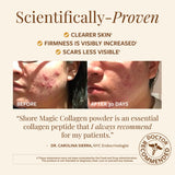 Shore Magic Marine Collagen Supplement 10g Peptides packet open with powder
