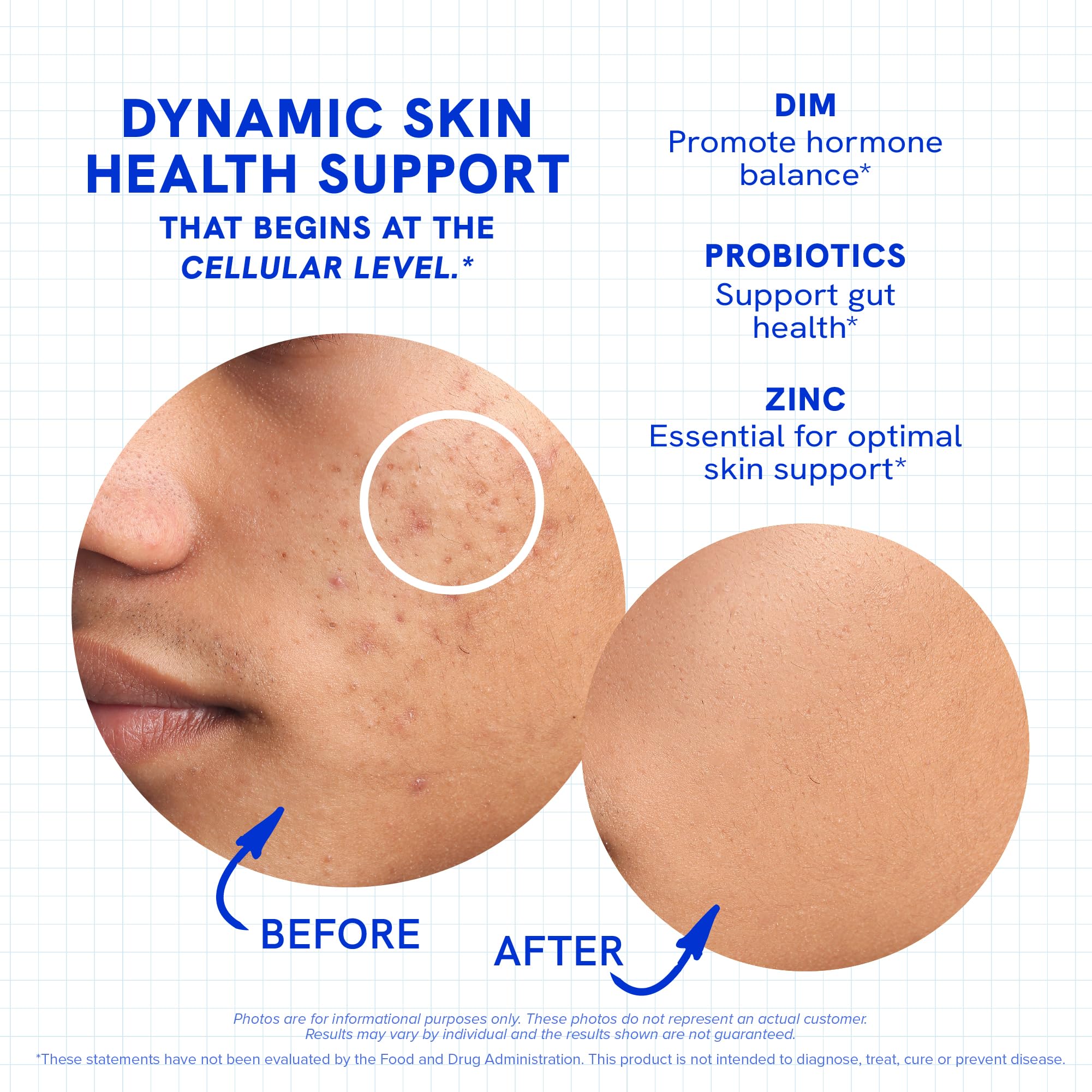 SMNutrition Clear Skin Supplement capsules in hand