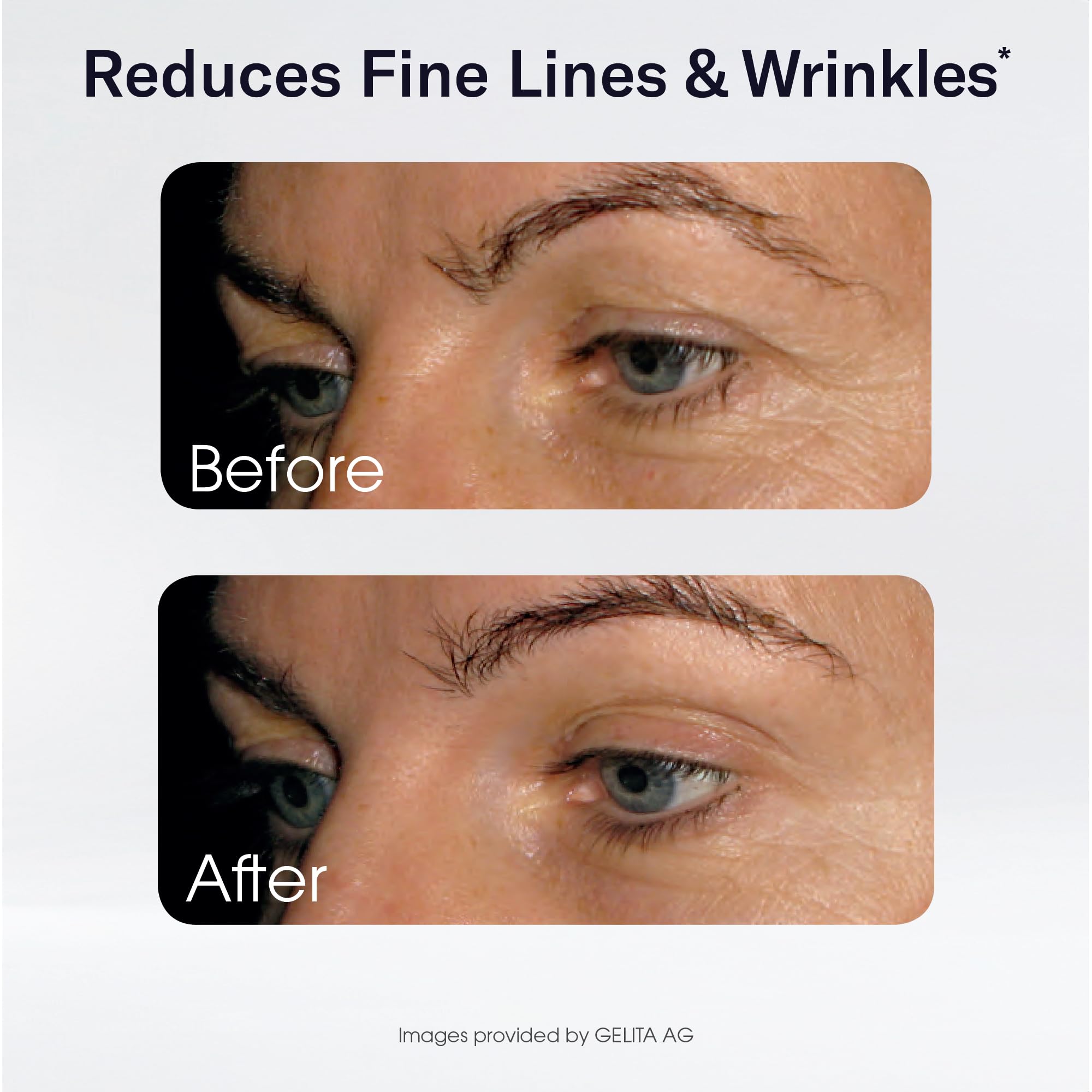 Sparkle Wellness Skin support Collagen Capsules lifestyle scene